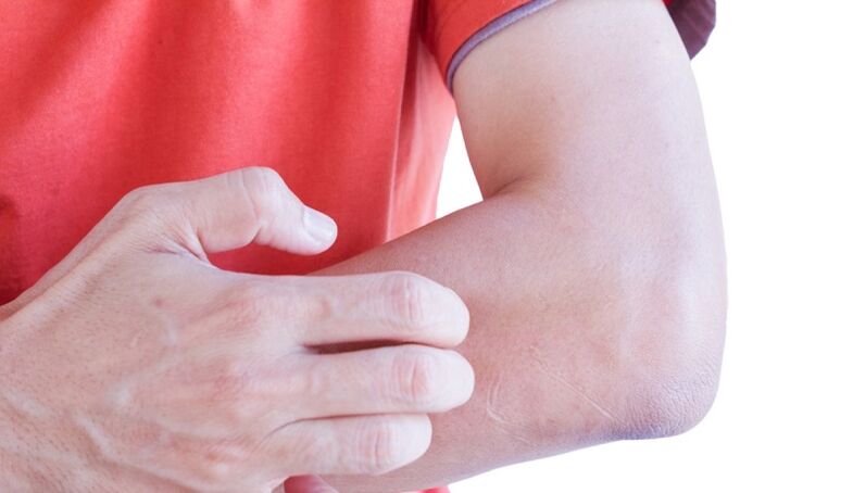 itchy skin as a symptom of parasites