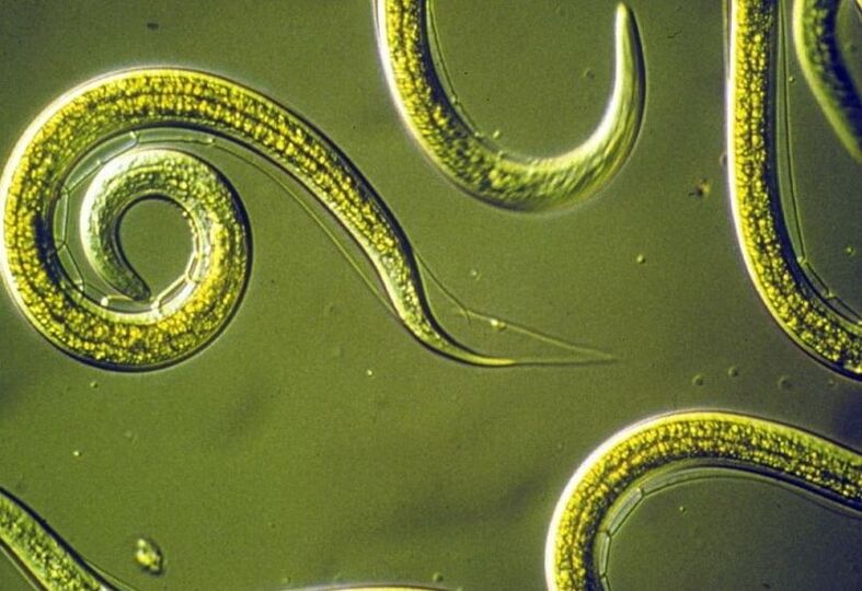 roundworms of the human body