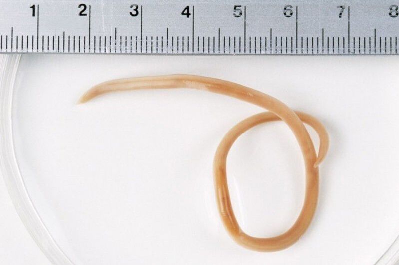 Size of worms in the body. 