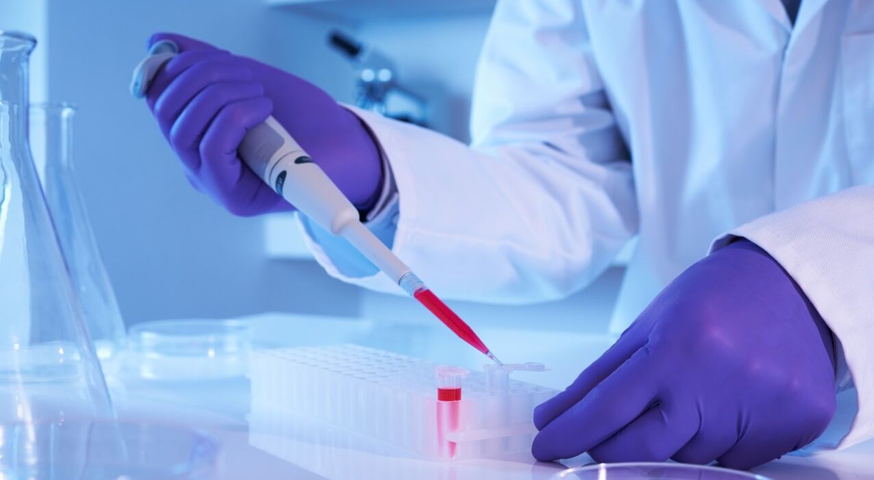 How to take a parasite analysis