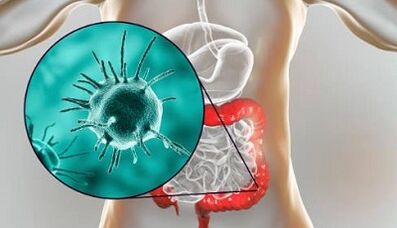 What evidence to take for parasites