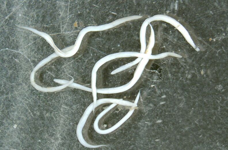 worm parasite of the human body