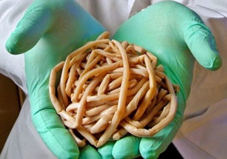Parasitic worms of the human body.