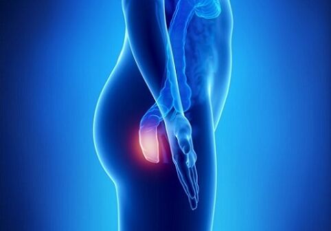 rectal itching as an indication for parasite testing