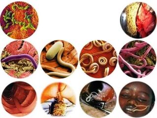 How to eliminate parasites from the body with home remedies. 